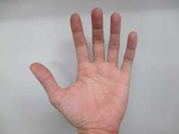 만약 손가락에 "이런 증상" 느껴진다면 바로 병원부터 가야합니다.