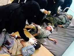사우디, 예멘 통학버스 폭격, 아동 수십명 사망…국제사회 비난 확산