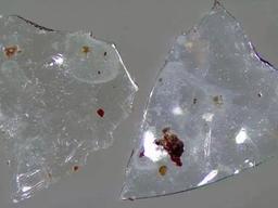 당신이 변기에 흘려버린 콘택트렌즈 밥상으로 돌아온다