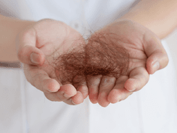 2030 탈모인, “아픈거지 웃긴 게 아니에요”