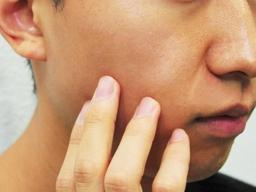 [찬바람 불면 더 아픈 건선 ②] 청소년건선을 아시나요…마음까지 다친답니다