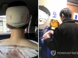 이수역 폭행 사건, "<strong>메갈</strong>이라 비하vs양쪽 말 들어봐야" 남녀 성대결로 확산 조짐