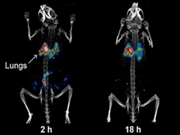 미세먼지 코 흡입… 이틀 뒤 폐에 60%가량 쌓여, 배출엔 일주일