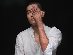 “세상에 흉터 없는 사람은 없잖아요” K-9 <strong>폭발</strong>부상자 이찬호 인터뷰