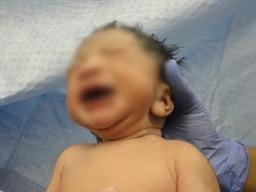 14년 식물인간 여성이 출산…30대 남자 간호조무사 체포