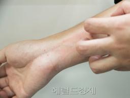 [겨울, 사막같은 내 <strong>피부</strong> ①]‘긁적긁적’ 나의 잠을 뺏어간 ‘<strong>피부</strong><strong>건조증</strong>’