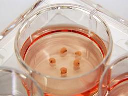 <strong>SF</strong>가 현실로… 인공뇌가 ‘의식’을 갖는다면?