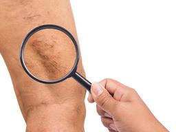 이런 증상 있다면 망설이지말고 당장 병원에 가야하는 이유