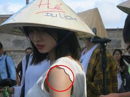 95년 이후 출생 아이돌 팔에만 보이는 특별한 자국의 정체