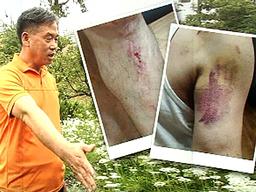 '쇠파이프 폭행' 당하고 2달 뒤에 또…피의자는 '입 꾹'