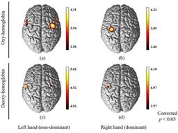 오른손잡이가 왼손 쓸때 좌우뇌 모두 관여