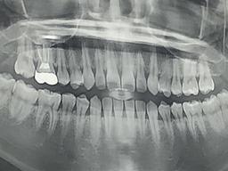 [해보니 시리즈 93] <strong>치과</strong> 여러 곳 찾아 '치료비 견적' 내보니
