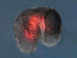 [IF] 살아있는 '세포 로봇', 몸속 여행하며 癌 치료