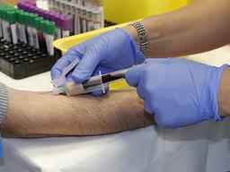 피 안 뽑고 <strong>레이저</strong>로 혈당측정 기술 개발