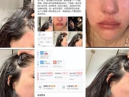 "소속사 사장에게 맞았습니다"...모델 <strong>반서진</strong> 충격적인 주장