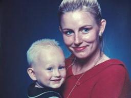 [Pick] "흉터보다 중요한 건…" 전신화상 입은 여성의 단단한 외침