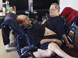 세계 최장수 몸 붙은 쌍둥이 68세 일기로 사망