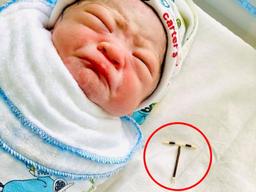 엄마 배 속에서 피임기구 쥐고 태어난 베트남 아기…2% 확률 통과