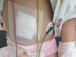 "다람쥐 같이 뛰어다니던 딸…<strong>퇴원</strong>하니 뒤뚱거리며 못 걸어"