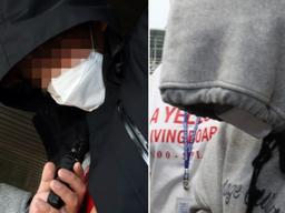 두피까지 벗겨지는 온몸의 화상 '그는 지옥에 살았다'