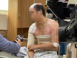 <strong>골프채</strong>로 때리고 불로 지지고…아파하자 원양어선 보내려 했다