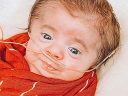 “안으면 부러져요”…유리왕자로 태어난 아기의 사연