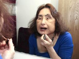 미국 첫 ‘페이스 오프’ 환자, 수술 12년 만에 세상 떠났다