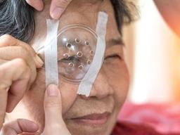 ‘소리 없는 시력 도둑’ <strong>녹내장</strong>, 70%가 정상 안압