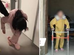 10년 넘게 구부린 채 산 中 ‘폴딩소녀’, 허리 펴고 찾은 꿈