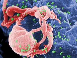 ‘슈퍼 면역력’으로 에이즈 자연 치유…기적의 <strong>완치자</strong> 발견