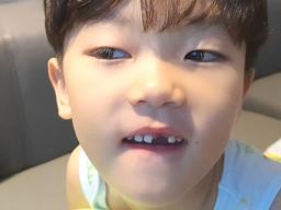 <strong>이동국</strong> <strong>아들</strong> 대박이, 앞니 쑥 빠져 "첫 유치 발치, 아빠는 이빨 뽑기 달인ㅋㅋ"