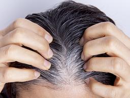 <strong>눈</strong>에 거슬린다고 새치 함부로 뽑지 마세요