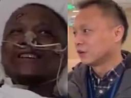 '까맸던 얼굴이' 코로나 극한 투병 중국인 의사 회복