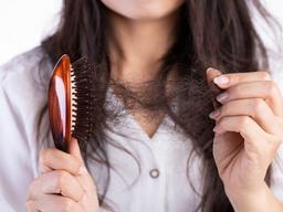 영양학자가 고른 탈모 예방 최고의 식품은?