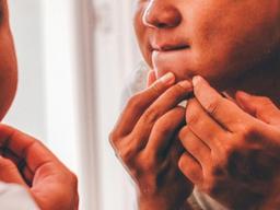 "<strong>여드름</strong> 짰을 뿐인데"…'폐 질환'으로 죽을 뻔한 남성