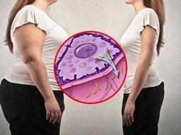 젊고 말라도 당뇨에 걸릴 수 있다? 당뇨병이 있다면 꼭 가져야 할 생활 <strong>습관</strong>