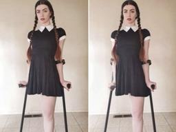 "포샵으로 한쪽 다리 지웠다고?"…외다리 모델, 악플과 투쟁