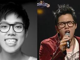 “<strong>렛미인</strong>에서 문자와” 슈스케5 임순영, 부정교합 양악수술 근황