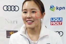 얼굴 베이는 역대급 <strong>사고</strong> 터졌을 때 김아랑 선수가 한 행동