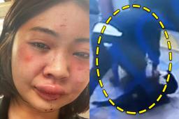 뉴욕 지하철에서 무자비 폭행 당한 아시아 모델이 직접 밝힌 당시 상황