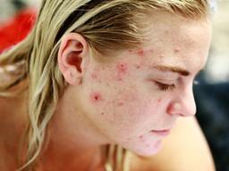 난소·유방·피부 그리고 전립선까지