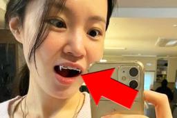 “요즘 유행인가?” 당황스러운 치아 상태 공개한 여가수의 사진