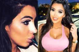 머리부터 발끝까지…성형에 무려 15억 투자했다는 모델의 미모 수준