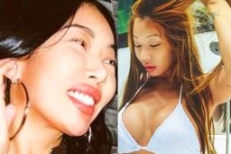 필러에 <strong>가슴 성형</strong>까지… ‘괴물같다’는 말에 여가수가 한 말