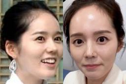 ‘탈모 위험’ 진단 받은 여배우의 평소 <strong>스타일</strong>보니 예상외로 심각했다