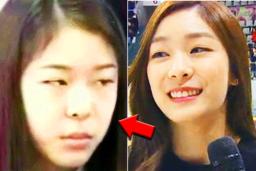 ‘10월의 신부’ 김연아가 해명한 15년 전 장면 “제가 왜 그런 표정 지었냐면…”