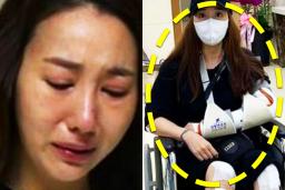 투병생활 고백했던 여배우 또 한번의 몸상태 공개되자 모두가 충격받았다