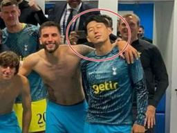 눈 퉁퉁 부은 손흥민 사진 공개, 부상 정도는