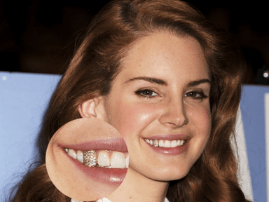 금니 빠짐과 원인, 아까운데 팔면 가격이 얼마 할까?