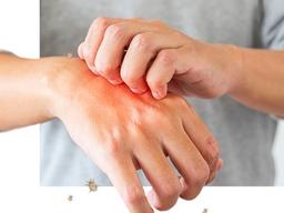 [카드뉴스] 몸이 간질간질~ 내 몸에 ‘옴’ 있다?